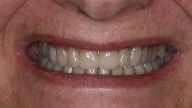 דוגמה לטיפול שיניים