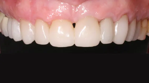 דוגמה לטיפול שיניים