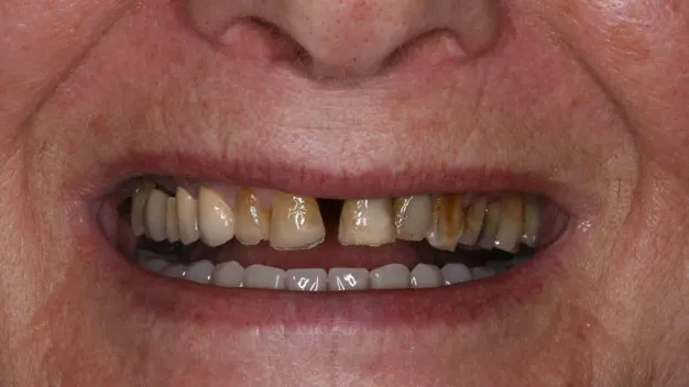 דוגמה לטיפול שיניים